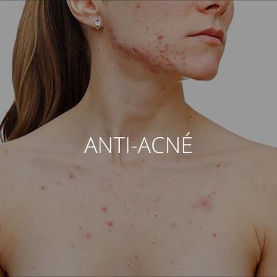 Anti-acné